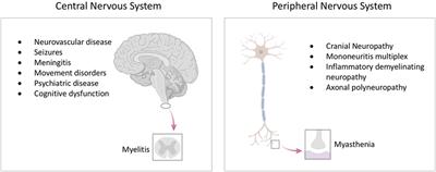 Neurological Disease in Lupus: Toward a Personalized Medicine Approach